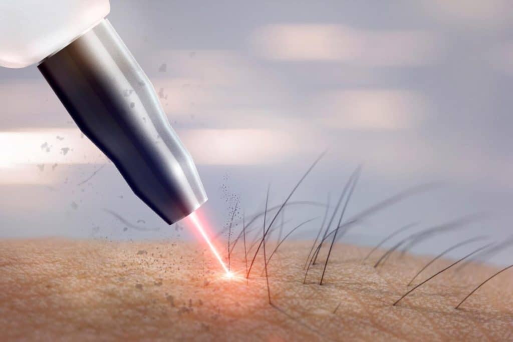7 Proven Benefits of Chest Laser Hair Removal for Men (And What to Know Before You Book) Image 1 of 7 Proven Benefits of Chest Laser Hair Removal for Men (And What to Know Before You Book)