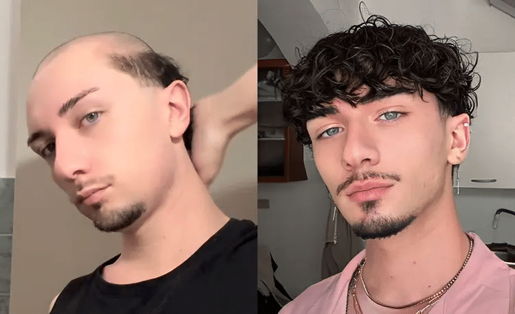 Custom Hair System vs. Stock Hair System Image 1 of Custom Hair System vs. Stock Hair System