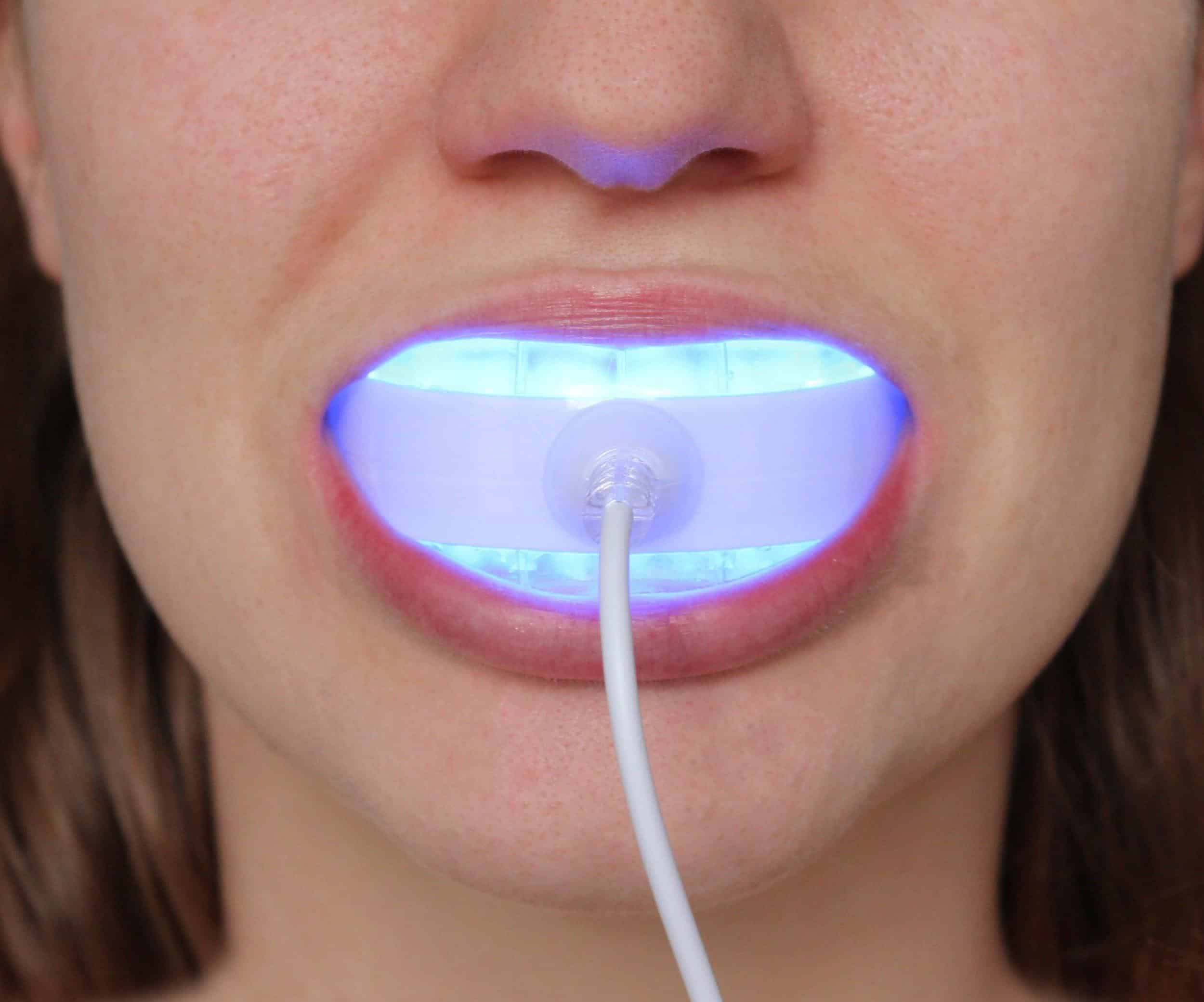 Home Teeth-Whitening LED Light Systems