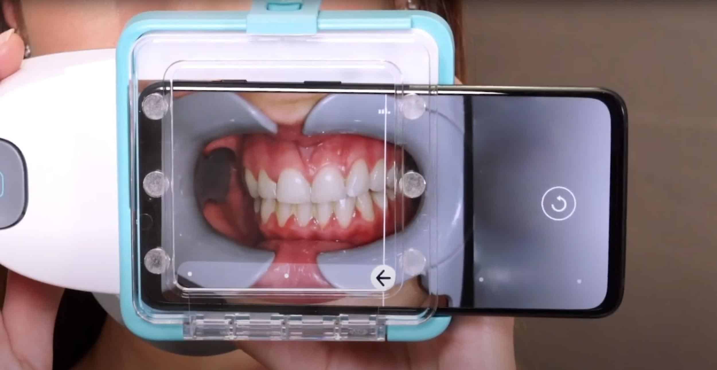 Smart Dental Cameras